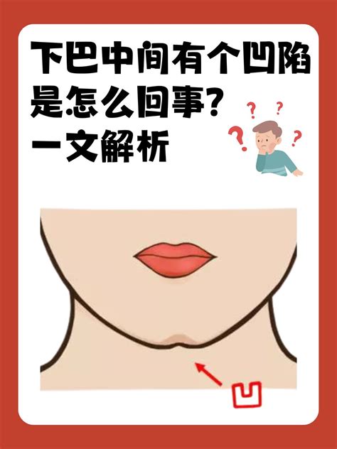 下巴凹槽|下巴有个凹陷是怎么回事？怎么办？